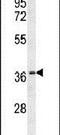 Olfactory Receptor Family 10 Subfamily X Member 1 (Gene/Pseudogene) antibody, PA5-24134, Invitrogen Antibodies, Western Blot image 