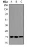 Ubiquitin Conjugating Enzyme E2 G1 antibody, orb382489, Biorbyt, Western Blot image 