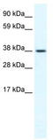 Transient Receptor Potential Cation Channel Subfamily M Member 3 antibody, TA341727, Origene, Western Blot image 