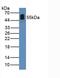 Angiopoietin Like 2 antibody, MBS2027758, MyBioSource, Western Blot image 