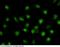 ESE-1 antibody, 101173-T34, Sino Biological, Immunohistochemistry paraffin image 