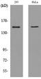 Protein Tyrosine Phosphatase Receptor Type J antibody, A02319-1, Boster Biological Technology, Western Blot image 