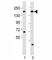 Lysine Demethylase 6A antibody, F53213-0.4ML, NSJ Bioreagents, Western Blot image 