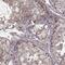 SLAIN Motif Family Member 2 antibody, NBP2-57345, Novus Biologicals, Immunohistochemistry paraffin image 