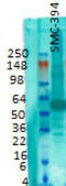 Solute Carrier Family 17 Member 7 antibody, TA326591, Origene, Western Blot image 