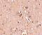 Mediator Complex Subunit 28 antibody, PA5-20572, Invitrogen Antibodies, Immunohistochemistry paraffin image 