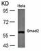 SMAD2 antibody, orb14694, Biorbyt, Western Blot image 
