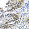 Dachshund homolog 1 antibody, STJ28975, St John