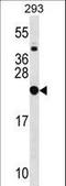 Ribosomal Protein L9 antibody, LS-C162720, Lifespan Biosciences, Western Blot image 