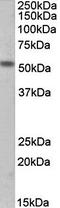 Cholinergic Receptor Nicotinic Epsilon Subunit antibody, orb79344, Biorbyt, Western Blot image 