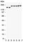 DCC Netrin 1 Receptor antibody, R31010, NSJ Bioreagents, Western Blot image 