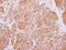 Tyrosine 3-Monooxygenase/Tryptophan 5-Monooxygenase Activation Protein Beta antibody, NBP1-33454, Novus Biologicals, Immunohistochemistry frozen image 