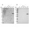 Sulfotransferase Family 2B Member 1 antibody, PA5-59696, Invitrogen Antibodies, Western Blot image 