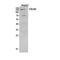 Collagen Type V Alpha 2 Chain antibody, STJ96898, St John