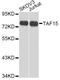 TATA-Box Binding Protein Associated Factor 15 antibody, A8465, ABclonal Technology, Western Blot image 