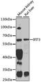 Interferon Induced Protein With Tetratricopeptide Repeats 3 antibody, A3924, ABclonal Technology, Western Blot image 