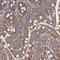 Mitochondrial Ribosomal Protein L48 antibody, PA5-59330, Invitrogen Antibodies, Immunohistochemistry paraffin image 