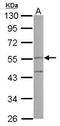 Peptidase Inhibitor 16 antibody, GTX121996, GeneTex, Western Blot image 