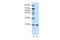 Ribosomal Protein L9 antibody, 29-214, ProSci, Enzyme Linked Immunosorbent Assay image 