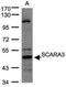 Scavenger Receptor Class A Member 3 antibody, NBP1-32130, Novus Biologicals, Western Blot image 