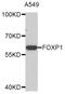 Forkhead Box P1 antibody, STJ23707, St John