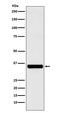 Exosome Component 7 antibody, M11141-1, Boster Biological Technology, Western Blot image 