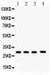 Carbonic Anhydrase 1 antibody, PA5-78896, Invitrogen Antibodies, Western Blot image 