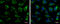 Ribonucleotide Reductase Regulatory Subunit M2 antibody, GTX103193, GeneTex, Immunocytochemistry image 