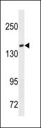 T Cell Lymphoma Invasion And Metastasis 1 antibody, LS-B9626, Lifespan Biosciences, Western Blot image 