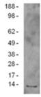 NADH:Ubiquinone Oxidoreductase Subunit A13 antibody, 14-9937-82, Invitrogen Antibodies, Western Blot image 