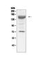 Insulin Like Growth Factor 1 Receptor antibody, A00070, Boster Biological Technology, Western Blot image 