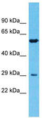 Transmembrane Serine Protease 11E antibody, TA330794, Origene, Western Blot image 