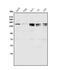 MutS Homolog 6 antibody, A00553-2, Boster Biological Technology, Western Blot image 
