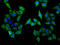 Solute Carrier Family 22 Member 5 antibody, LS-C681354, Lifespan Biosciences, Immunofluorescence image 