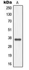 Melanocortin 4 Receptor antibody, LS-B14539, Lifespan Biosciences, Western Blot image 