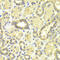 Mitogen-Activated Protein Kinase Kinase 2 antibody, 13-107, ProSci, Immunohistochemistry frozen image 