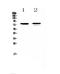 Frizzled Class Receptor 3 antibody, A04680-1, Boster Biological Technology, Western Blot image 