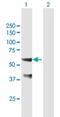 Sorting Nexin 25 antibody, H00083891-B01P, Novus Biologicals, Western Blot image 