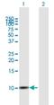 Secreted LY6/PLAUR Domain Containing 1 antibody, H00057152-B01P, Novus Biologicals, Western Blot image 