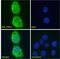 Tumor protein D52 antibody, 46-506, ProSci, Enzyme Linked Immunosorbent Assay image 