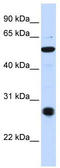 Zinc Finger Containing Ubiquitin Peptidase 1 antibody, TA345514, Origene, Western Blot image 