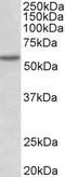 Programmed Cell Death 4 antibody, TA311422, Origene, Western Blot image 