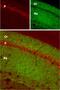 Glutamate Ionotropic Receptor AMPA Type Subunit 1 antibody, PA5-77415, Invitrogen Antibodies, Immunohistochemistry frozen image 