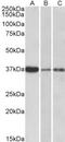 Interleukin 12B antibody, NB100-61661, Novus Biologicals, Western Blot image 
