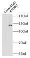Bone Morphogenetic Protein Receptor Type 2 antibody, FNab00924, FineTest, Immunoprecipitation image 