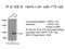 Telomere Maintenance 2 antibody, 15975-1-AP, Proteintech Group, Immunoprecipitation image 