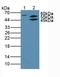 AKT Serine/Threonine Kinase 2 antibody, LS-C701172, Lifespan Biosciences, Western Blot image 