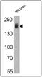 Erb-B2 Receptor Tyrosine Kinase 4 antibody, MA5-13016, Invitrogen Antibodies, Western Blot image 