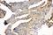 Junction Plakoglobin antibody, LS-C344038, Lifespan Biosciences, Immunohistochemistry paraffin image 
