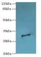 Outer Dense Fiber Of Sperm Tails 3 Like 1 antibody, A66122-100, Epigentek, Western Blot image 